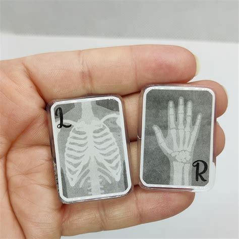 Witchcraft xray markers